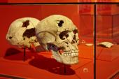 MAMUZ Museum Mistelbach - In den Knochen gespeichert - Krankheitsgeschichten aus der La Tène Zeit